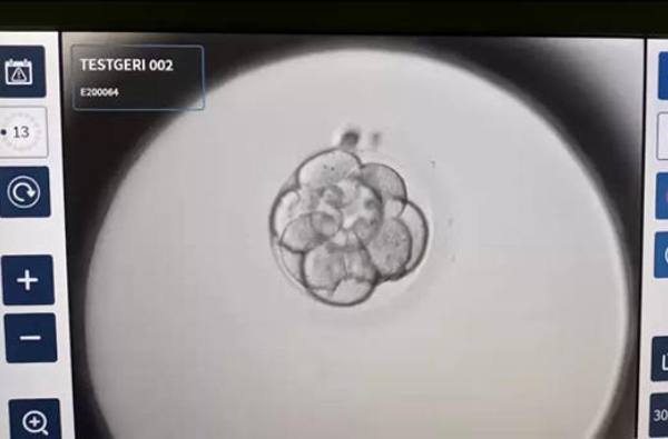 什么是试管婴儿胚胎培养液？有什么作用？