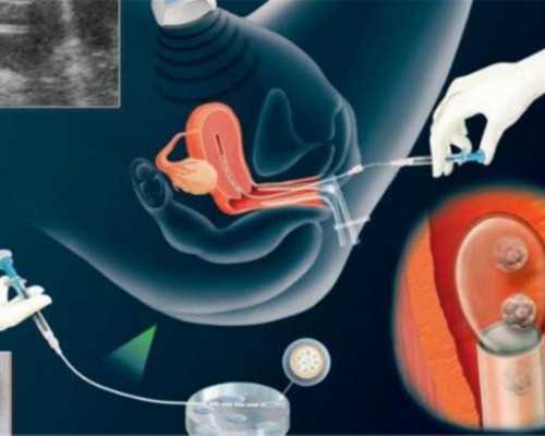 正规试管婴儿私立医院排名与特色解析