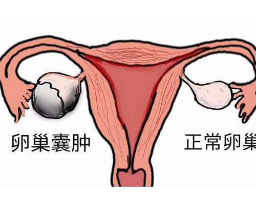 2024年顶尖供卵试管医院排名及选择指南