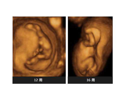 温州乐清试管婴儿医院选择与邵逸夫助孕成功率解析