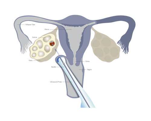 试管医院名单与费用解析:助孕选择指南