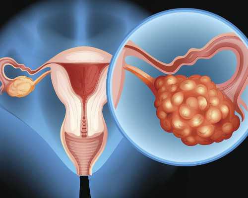 温州乐清试管婴儿医院及助孕服务指南