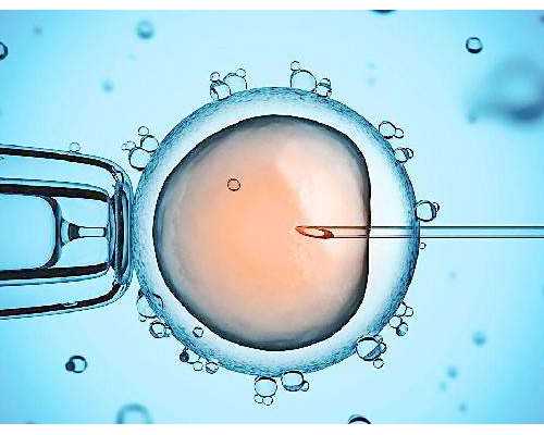助孕生宝宝费用解析:从几万到几十万不等