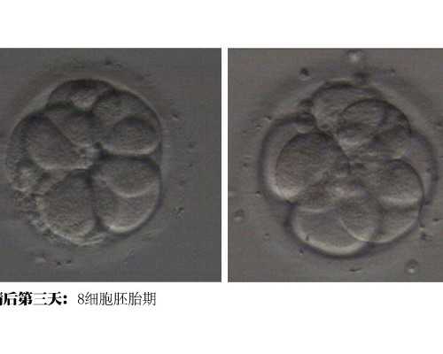 浙江试管婴儿医院选择指南及三代费用解析
