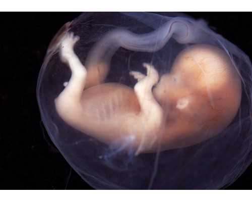 温州代怀双胞胎与试管婴儿医院选择指南及费用解析